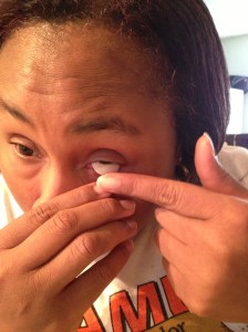 Empish inserting ocular lens in her eye