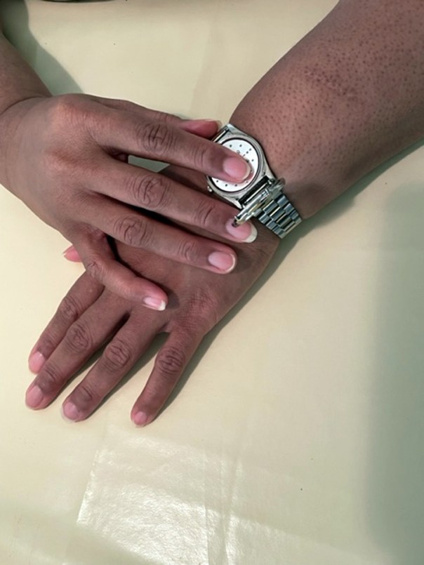 A braille watch is on the wrist of one hand with the top open. While the other hand figures out the time by pressing a finger on the raised display.
